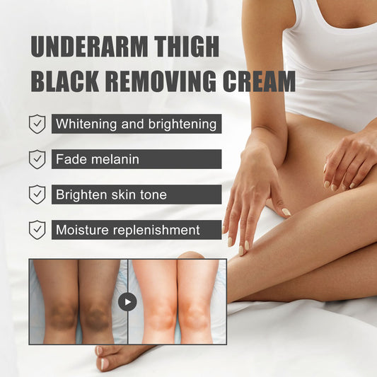 Anti-Darkening Cream Whitening Cream For Underarms And Thighs, Joint Skin Care Cream