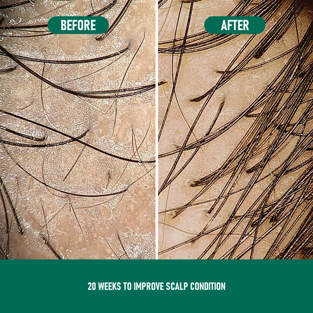 PHOFAY Growth Hair Serum