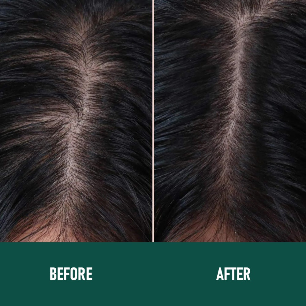 PHOFAY Growth Hair Serum